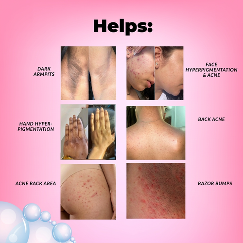 Girls Detox graphic with refined lighting and the original layout